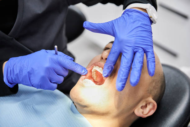 Best Broken or Cracked Tooth Emergency Dentist in Succasunna, NJ